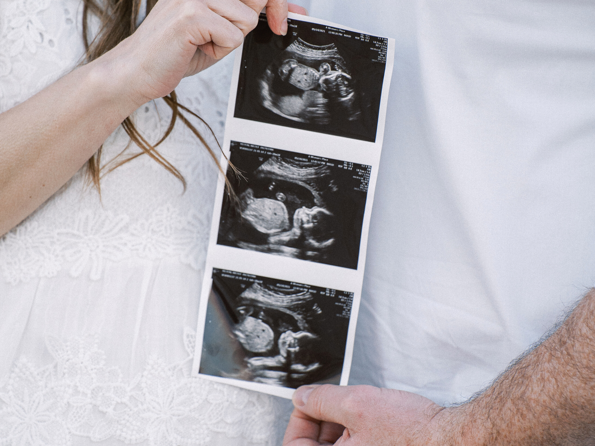 pregnancy announcement ultrasound